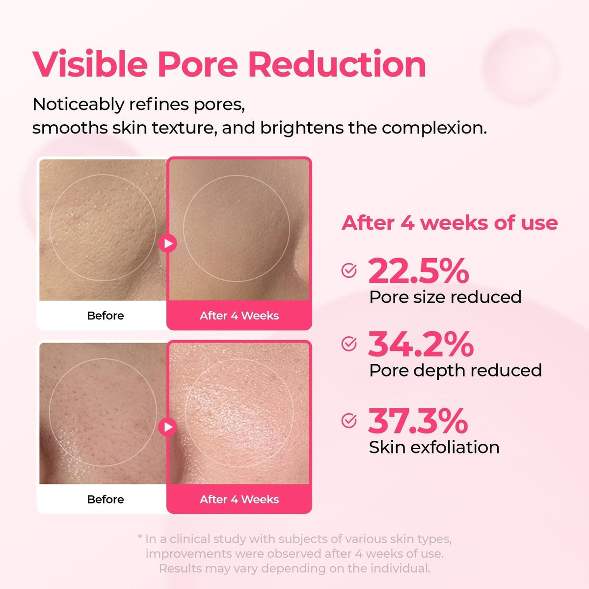 [FREE GIFT]🏆 #1 ON TIKTOK | 10-Step Skin Renewal Routine Set