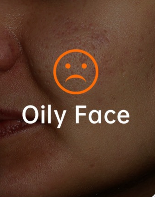 Skin Problem Indicator