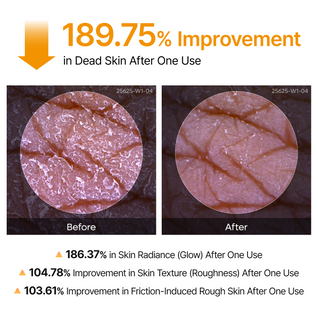 Peel Shot Keratin Care Kojic Acid Turmeric Spray