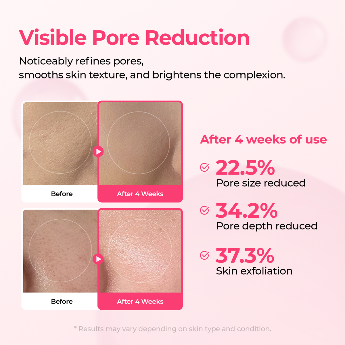 [TikTok Bestseller] Lumi Pore & Spot Care Duo